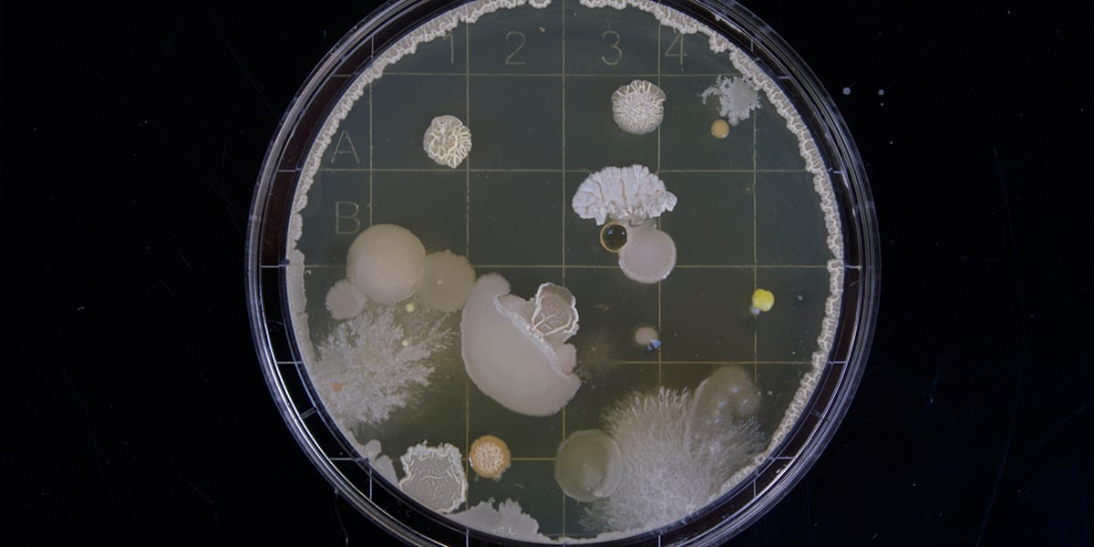 petri dish with things growing on it
